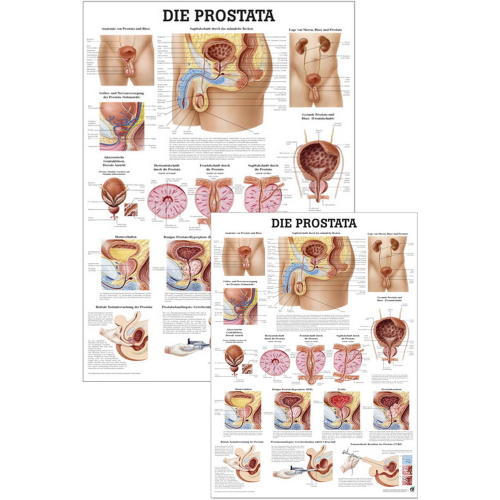 Öffne Lehrtafel "Prostata"