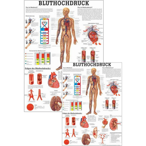 Öffne Poster "Bluthochdruck"