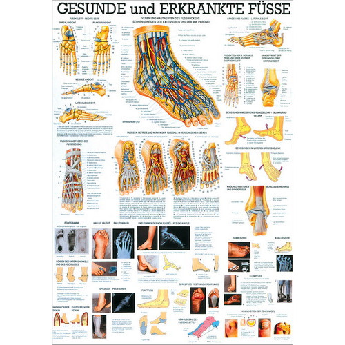 Öffne Lehrmittel über gesunde und erkrankte Füße, Lehrtafel